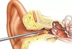 挖耳屎视频,趣味视频带你探索耳道清洁的奥秘